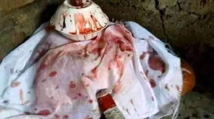 ​AUSTRALIA  (((+27631898589 )) BEST DEATH SPELL CASTER IN SYDNEY / REVENGE SPELLS CASTER IN MELBOURNE, CANBERA, ADELAIDE,  DARWIN, HOBART, WOLLONGONG, NEWCASTLE, CAIRNS, BLACK MAGIC SPELLS CASTER IN AUSTRALIA HEX SPELLS CASTER IN WARRNAMBOOL, BENDIGO, STRONG LOVE SPELLS CASTER IN ADELAIDE, AUSTRALIA POWERFUL DEATH SPELLS IN  PERTH, BURNIE, MAYBOROUGH, TOOWOOMBA, VOODOO DOLL SPELLS IN BRISBANE, CAIRNS, STRONG VOODOO DOLL SPELLS IN PORT AUGUSTA, BALLARAT, GEELONG, WAGGA WAGGA, POWERFUL DEATH SPELLS CASTER IN TOWNSVILLE CITY, LANCESTON POWERFUL PROTECTION SPELLS CASTER IN GLADSTONE CENTRAL +27631898589 Powerful Death Spells Caster In The World, USA, UK, Australia, Canada,Singapore, New York, Arkansas, Ohio.+27631898589 Chief khan, How To kill ex lover, husband,wife girlfriend Enemies without delay. It doesn't matter whether he or she is in another Country orState. I guarantee you to have your results you are looking for immediately. Just make surebefore you contact me you are committed and you want what you are looking for (Victim Death)because my death spell work fast overnight after casting the spells. Immediately working blackmagic death spells that work fast will be cast on the person and result is 24hours. Chief khan is aVoodoo -witchcraft spell caster who A LOVE SPELLS THAT WORK IMMEDIETLY How To CastA Death Spell On Someone, Death Spells That Work Overnight to kill wicked Step-dad/Stepmom.+27631898589 Chief Khan: EMAIL; khankhandr94@gmail.com WEBSITE;https://khankhandr94.wixsite.com/website Death Revenge Spell on wicked friends, Voodoo Death Spells to kill Enemies, BlackMagic Spells To Harm Someone, Black magic death spells on ex-lover, Revengeinstant death spells on uncle, Instant death spells caster, successful death spell,most powerful death spell, death spells that work fast, spell to die in your sleep,death spells that work overnight, voodoo death spells, death spell chant, mostpowerful death spell, revenge spells that work instantly, spell to die in your sleep,voodoo death spell caster, spell to make someone sick and die, revenge spells,breakup spell, spells to punish someone, revenge spells on an ex- lover, revengespell caster, revenge spells that work instantly, spell to make someone sick, how toput a spell on someone who hurts you, voodoo spells to hurt someone, death spellson my ex-lover husband wife boyfriend girlfriend, I need death spells caster, I wantmy ex-husband, wife, girlfriend, boyfriend, dead overnight, voodoo death spell to killmy ex-lover, I need overnight death spell caster. Voodoo death spells, black magicvoodoo spells, spell to make someone sick and die, death spells that work fast,death spells that work overnight, spell to die in your sleep, black magic spells toharm someone, most powerful death spell, spells to curse someone, spell makesomeone die, revenge spells. Here are some of the basic harm that is inflicted uponpeople using black magic to Kill Someone Overnight.+27631898589 chief khanEmail: khankhandr94@gmail.comWEBSITE: https://khankhandr94.wixsite.com/website