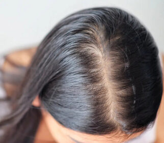 hair-loss-treatment